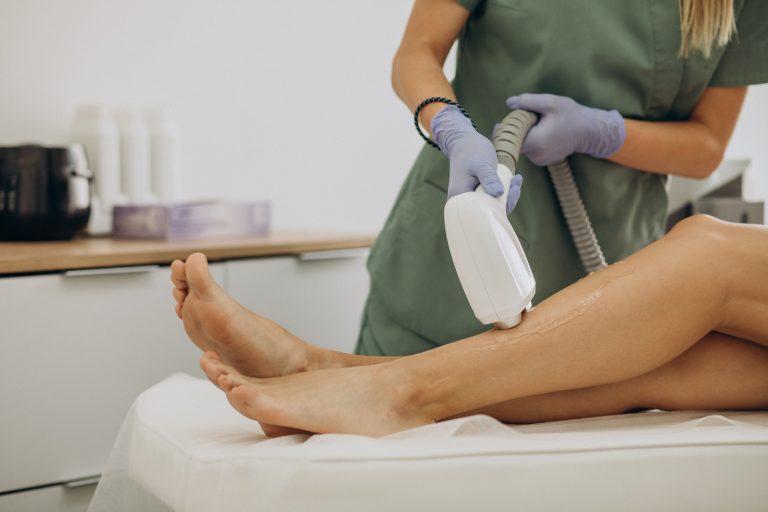 Laser épilatoire, hair removal therapy