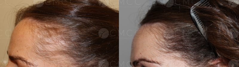 CAS FUE FEMME 1 1 800x225 1