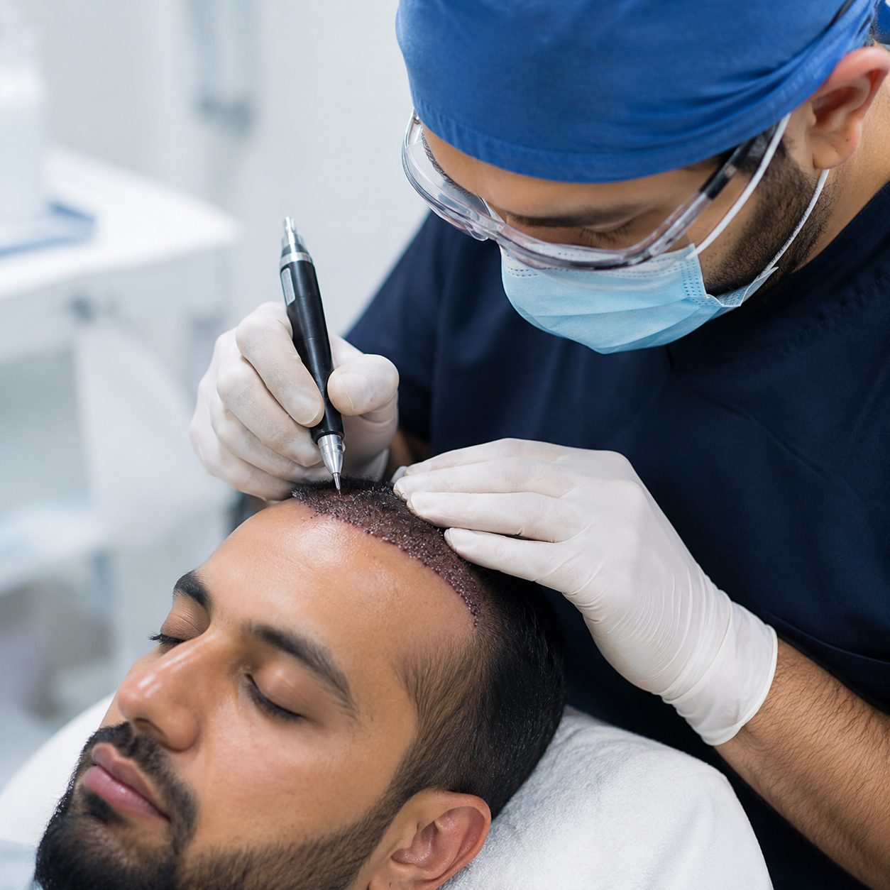 Greffe de Cheveux en Tunisie Technologies Avancees Ligne Frontale Naturelle et Haute Densite chez Saphir Hair Clinic Tunisia