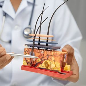 Greffe de cheveux ratée