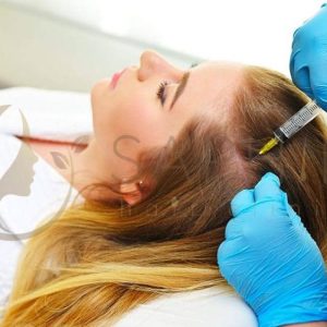 Prp, Mésothérapie Et Exosomes Dans La Greffe De Cheveux