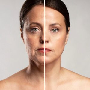 Saphir Sculpt Lift™ en Tunisie